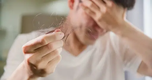 Receding Hairline 