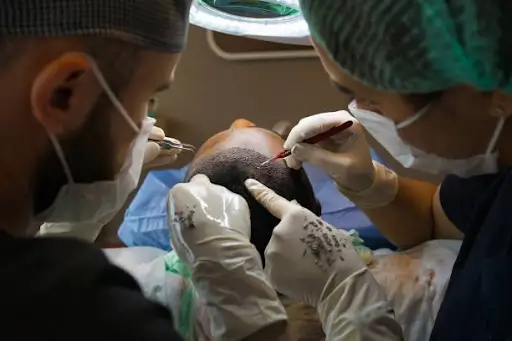 Turkish and UK Hair Transplants