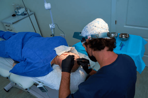 Hair Transplant